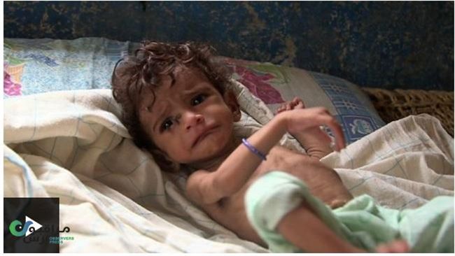 BBC..المجاعة تهدد أغلب السكان باليمن ومنظمات تصف الوضع بالفادح