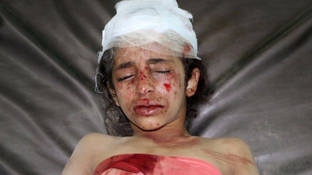 BBC:انتهاكات واسعة لحقوق الاطفال  في اليمن فهل من محاسبة عليها؟