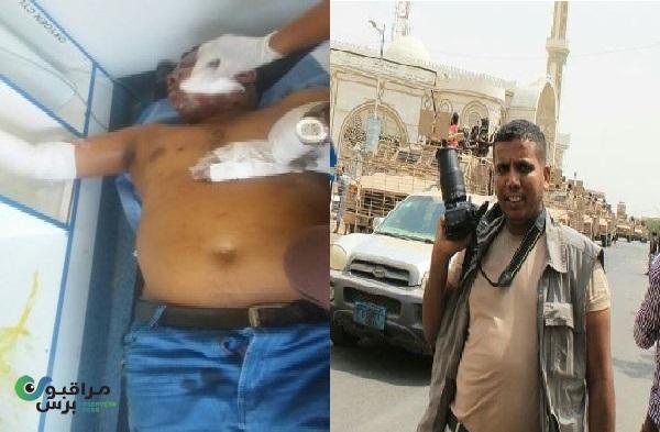 وكالة عالمية تؤكد اصابة مصور يمني متعاون معها بشظايا صاروخ مسير