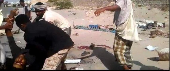 اذاعة تكشف عن مقتل 40 شخصا واصابة العشرات بمعارك ضارية باليمن
