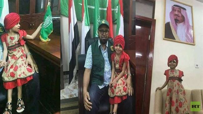 الطفلة اليمنية"بثينة" في السعودية بعد إعلان صالح تبنيها والحوثي يستنكر