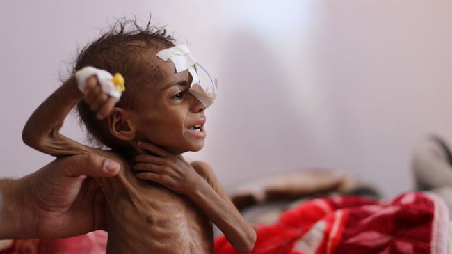 الامم المتحدة تدعو اطراف النزاع في اليمن الى وقف التصعيد العسكري