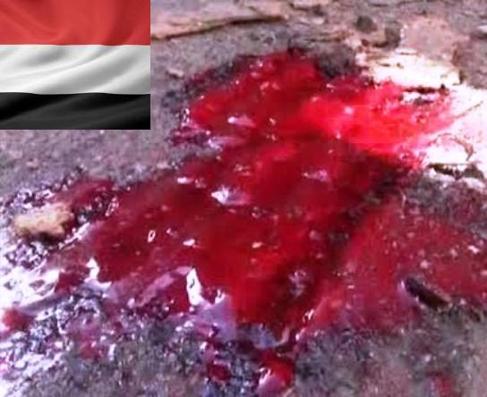 جريمة قتل وحشية بحق شاب يمني وسط العاصمة صنعاء 