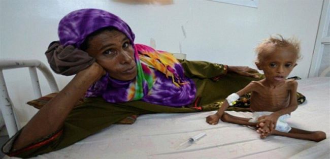 الحكومة اليمنية تكشف كيف "نهب" الحوثي اليمن وتسبب بأسوأ كارثة إنسانية بالعالم 