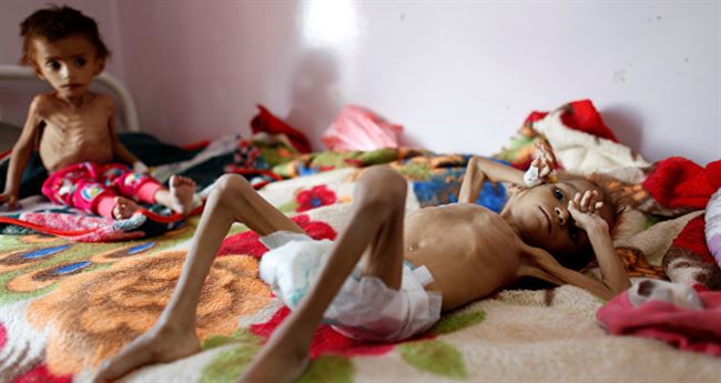 منظمة تكشف أرقاما وإحصائيات مروعة عن الظروف التي يعيشها أطفال اليمن