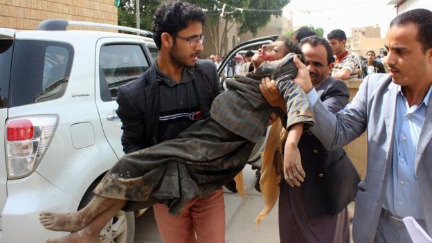 بي بي سي تتساءل:لماذا يعجز المجتمع الدولي عن حماية أطفال اليمن؟(تقرير)