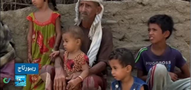 قناة ترصد معاناة قرية للمكفوفين باليمن وسبب تفشي العمى بين سكانها(فيديو)