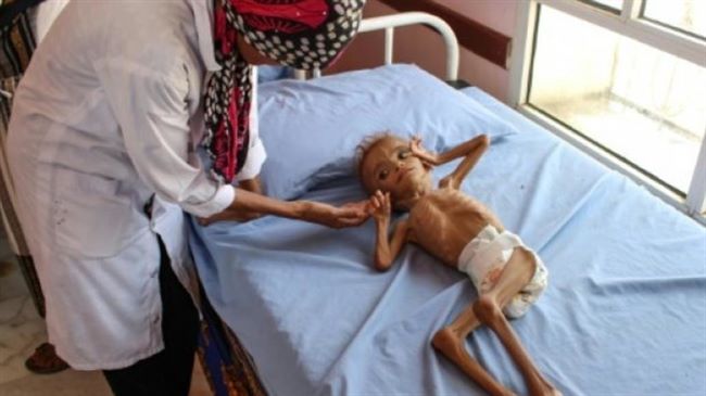 الأمم المتحدة تدق ناقوس الحذر مجدداً من عودة شبح المجاعة إلى اليمن